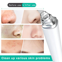 Electric Blackhead Removal Facial Cleansing Device